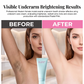 🧴50% OFF NOW! Gentle Hair Removal Cream for Men & Women, Fast‑Acting Moisturizing Depilatory Cream, Ice Cooling & Sensitive Skin Formula for Underarm, Bikini Line & Whole‑Body Hair Removal